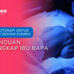 Fototerapi untuk Bayi Demam Kuning