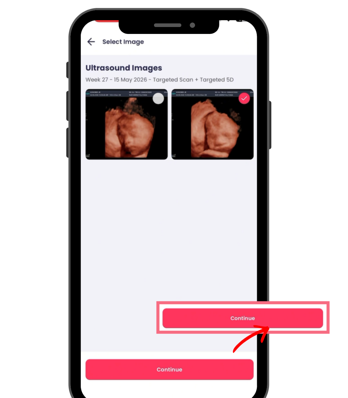 Select Your Ultrasound Image
